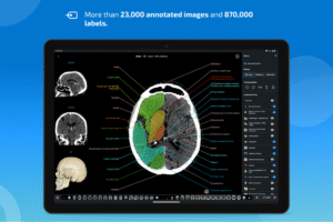 IMAIOS e-Anatomy 7.9.3 screenshot 10