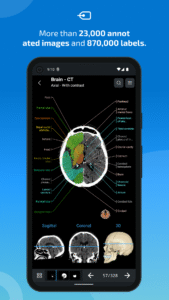 IMAIOS e-Anatomy 7.10.0 screenshot 2