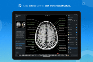 IMAIOS e-Anatomy 7.10.0 screenshot 13