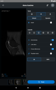 IDV - IMAIOS DICOM Viewer 2.5.0 screenshot 11