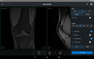 IDV - IMAIOS DICOM Viewer 2.5.0 screenshot 17