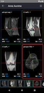 IDV - IMAIOS DICOM Viewer 2.5.0 screenshot 3