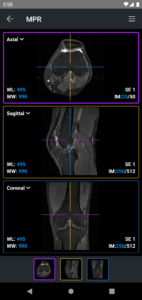 IDV - IMAIOS DICOM Viewer 2.5.0 screenshot 4