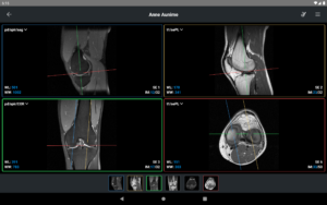 IDV - IMAIOS DICOM Viewer 2.4.4 screenshot 15