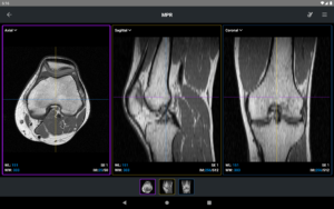 IDV - IMAIOS DICOM Viewer 2.4.4 screenshot 16