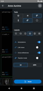 IDV - IMAIOS DICOM Viewer 2.4.4 screenshot 5