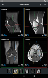IDV - IMAIOS DICOM Viewer 2.4.4 screenshot 9