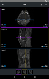 IDV - IMAIOS DICOM Viewer 2.4.4 screenshot 10